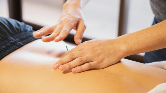 Practitioner inserting an acupuncture needle into a patient's back