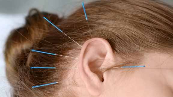 holisticphysio holistic physio exercise pregnancy stress anxiety womens health services pain acupuncture migraine work fatigue depression
