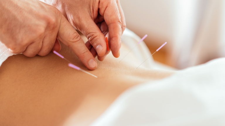 holisticphysio holistic physio exercise pregnancy stress anxiety womens health services pain acupuncture migraine work fatigue depression